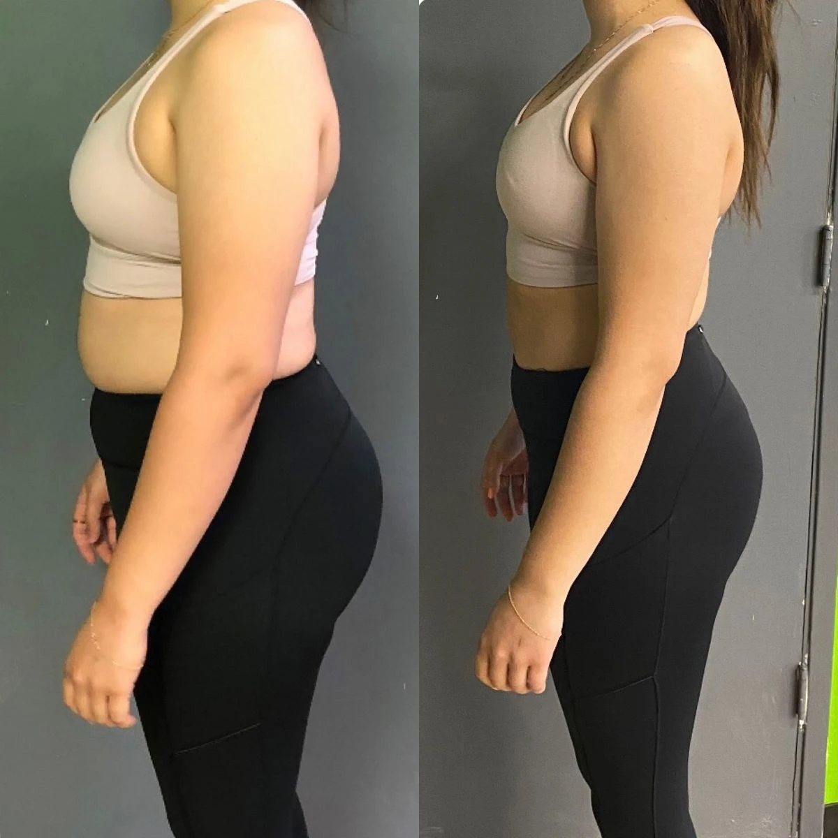 Antes e depois de aluna, de perfil